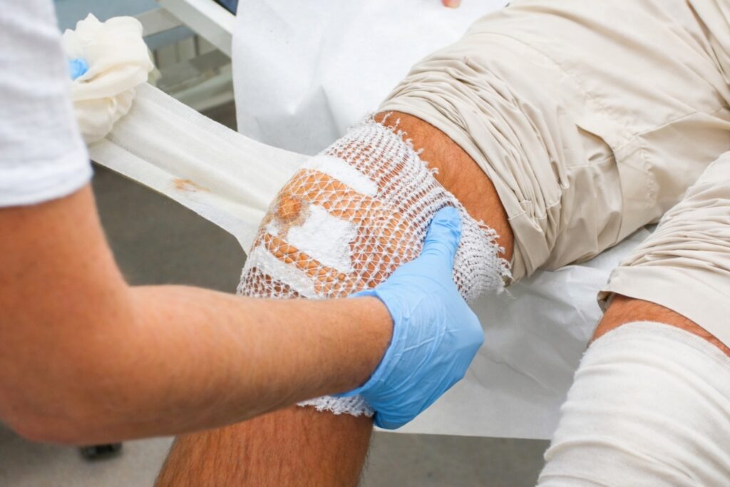 A close-up of a healthcare worker in blue gloves applying a gauze bandage to a patient's leg wound.