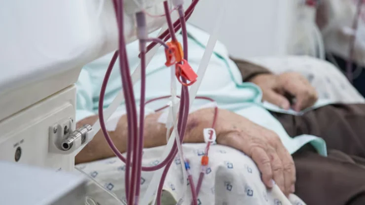 Dialysis fistula access during hemodialysis session